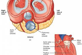 Prosthetic Valves 3: Types Of Valves image