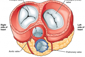 Prosthetic Valves 1: General Approach image