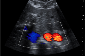 The Physics Of Ultrasound 2: Tissue image