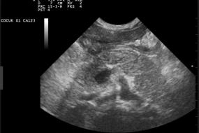 Ultrasound of a human fetus