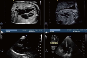 The Physics Of Ultrasound 1: Sound image