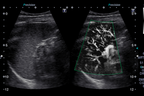 The Physics Of Ultrasound 5: Hemodynamics Mechanics image