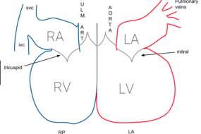 Aortic Valve 4: Aortic Valve Surgery image