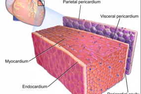 Masses, Pericardial And Myocardial Disease 2: Tumors image