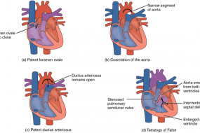 Congenital Heart Disease In Adults 1: Terminology And Embryology image