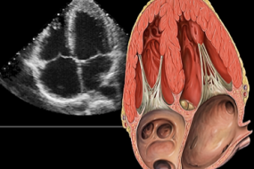 Echo Exam 2: Basic TEE, TTE, And Emergency Algorithms image