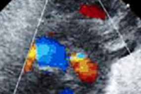 The Physiology Of The Fetal Cardiovascular System image