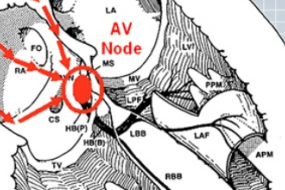 Pediatric ECG Basics image